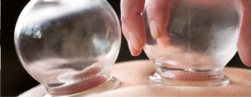 Got issues in your tissues Massage cupping can help